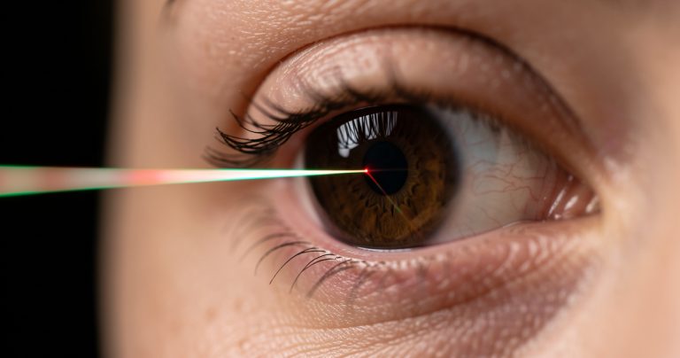 Laser SMILE : la chirurgie mini-invasive de la myopie et de l'astigmatisme