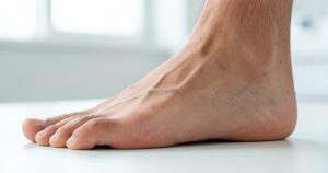 Lisfranc pied : comprendre cette blessure du médiopied